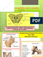 Luxación Congénita de La Cadera