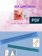 Apertura de Endodoncia en Diente Anteriores