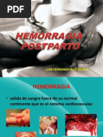 Hemorragia Postparto