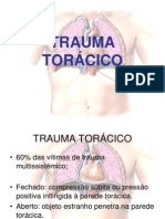 Trauma Torácico