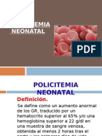 Policitemia Neonatal