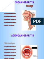 Adenoamigdalitis