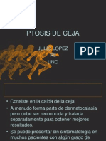 Ptosis de Ceja y Dermatocalasia