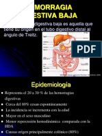 Hemorragia Digestiva Baja