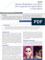 Prosthetic Rehabilitation of A Patient With Congenital Oro-Nasal Defect: A Case Report