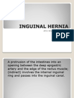 Inguinal Hernia