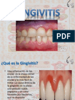 Gingivitis Jornada