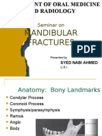 Mandibular Fractures 