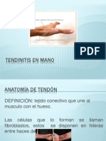 Tendinitis en Mano