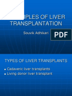 Principles of Liver Transplantation