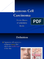 Squamous Cell Carcinoma