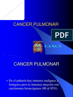 Cancer Pulmonar