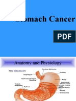 Stomach Cancer