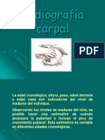 Radiografía Carpal