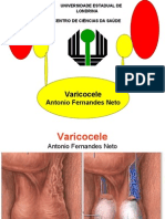 Varicocele