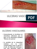 Ulceras Vasculares