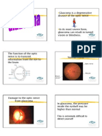 This Is Extremely Difficult To Detect Yourself: Optic Nerve