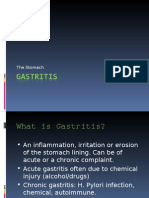 Stomach - Gastritis