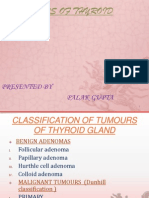 Tumours of Thyroid Gland