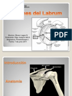 Lesiones Del Labrum