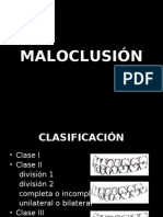 Maloclusiones I, II, III y MINSA