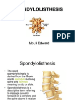 SPONDYLOLISTHESIS