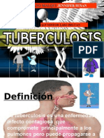 Tuberculosis