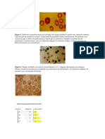 Reticulocitos PDF