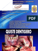 Quiste Dentigero