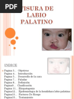 Labio Palatino PDF