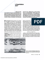 Pericardial Effusion 2