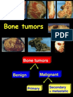 02 Bone - Tumors