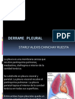 Derrame Pleural