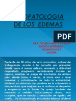 Fisiopatologia de Los Edemas