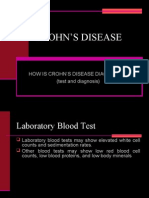 Crohn's Dse