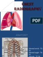 Chest Radiography