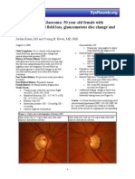 86 Normal Low Tension Glaucoma