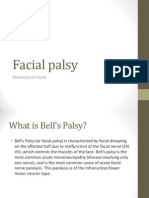 Cn7 Palsy (Bells Palsy)