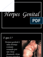 Herpes Genital