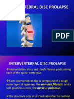 Intervertebral Disc Prolapse