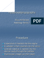 Hysterosalpingography