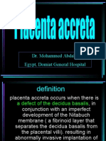 Placenta Accreta