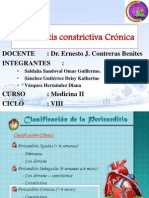 Pericarditis Constrictiva Seminario