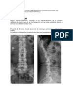 LUMBARIZACION