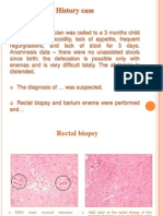 Hirschsprung Disease