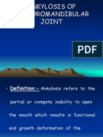 ANKYLOSIS of TMJ Oral Surgery