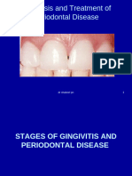 Diagnosis and Treatment of Periodontal Disease