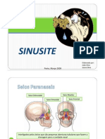 Sinusite