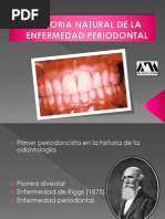 Historia Natural de La Enfermedad Periodontal