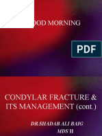 Condylar Fracture & Its Management